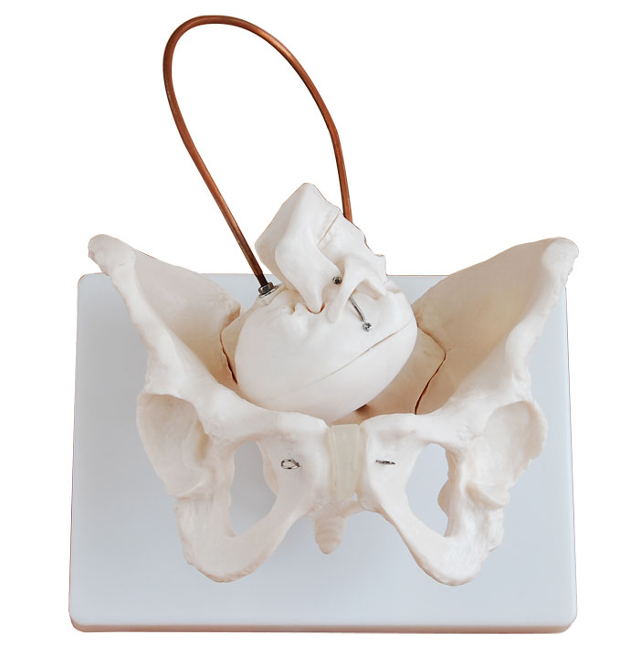 女性盆骨带胎儿头颅骨模型
