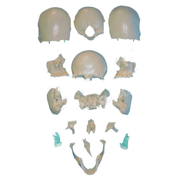 部分颅骨散骨模型