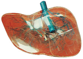 透明肝模型