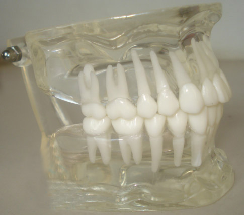 牙齿标准模型