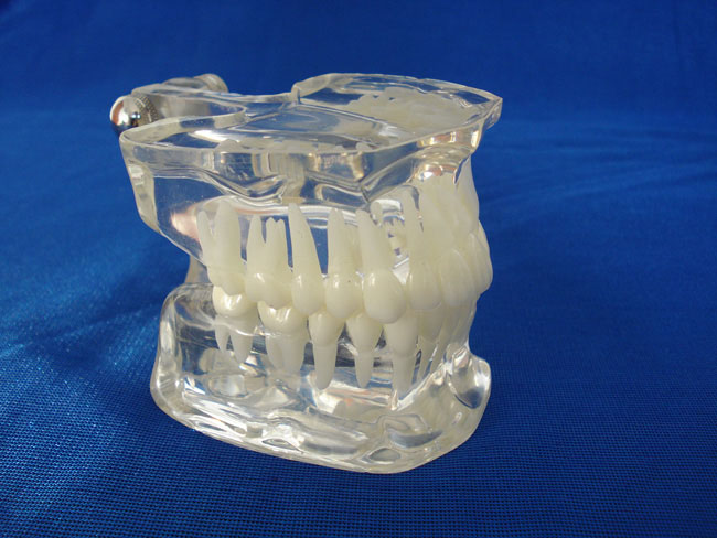 标准水晶牙列模型(德frassaco颌架)