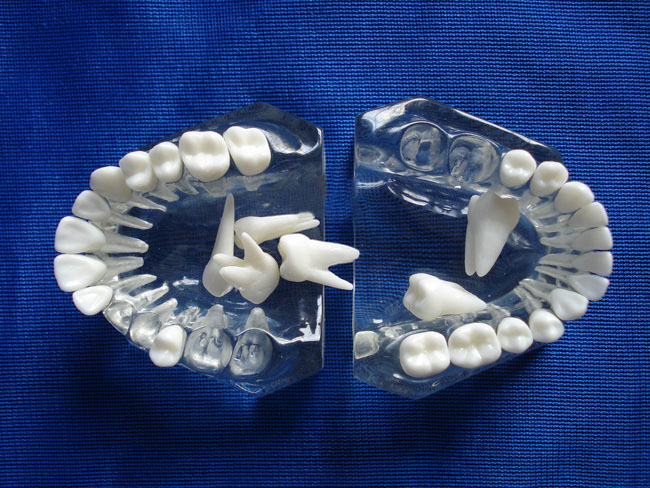 标准水晶牙列模型(全口牙可拆)