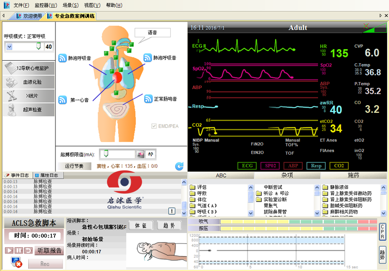  高智能数字化综合急救技能训练系统（ACLS高级生命支持、计算机软件控制）